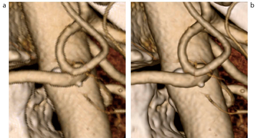 }3@FomulaGWɂ郌_O aF]̃_OivObVujB]IpVeBς肷ƁC̃_Oi𑜓xjɂȂB bFFormulaGWɂ郌_OB]IpVeB̕ωȂǁC̑̑sĂɍō掿Ŋώ@łB