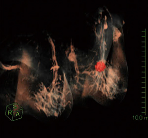 }1@ PRISMAɂᇂƖǂ̎O`o 