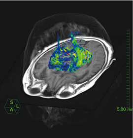  }2@DTI̓\tgEFAiW.I.P.j