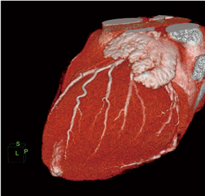 }3@FORMULAɂ鍂掿S摜 擾ZpPRISMAɂāC掿C\𑹂ȂƂȂC4DC[W񋟂łB