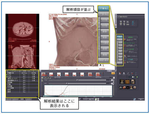 図2　肝臓解析の初期画面