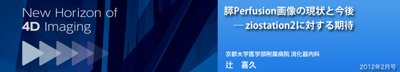 XPerfusion摜̌ƍ\ziostation2ɑ΂ҁ@swwa@ ȁ@ҁ@v