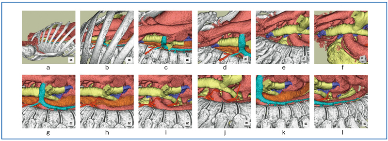 図3　内視モードによる胸腔鏡下手術シミュレーション 肋間から胸腔内に入り大血管、気管支動脈、奇静脈、食道、リンパ節を手術術式に準じて観察する。胸腔内に入ったのちに上部を鎖骨下動脈近傍まで観察する（a〜ｆ）。次いで、尾側に視野を移動し、胸部下行大動脈手前腹側の食道、気管分岐下リンパ節等を観察する。温存すべき気管支動脈と周囲構造の関係が明瞭である（g〜l）。