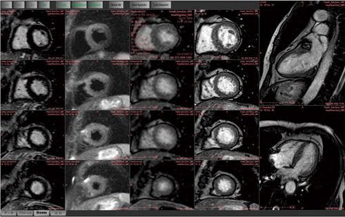 }1@MRS@\͂̃r[ʃtbN邱ƂŁCXgX̂Ȃ摜ώ@\