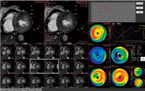 }2@MRS@\͌ʂɍœKꂽ\CAEg Bull's eye map1ʏɕ\\