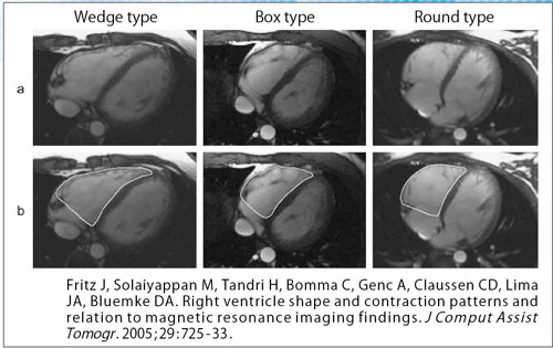 }2@E`̌l Ě`ɂ͌l傫CɏL3QɕނB Wedge typeFEORǂłC[̐Op` Box typeFEORǂł͂ȂC^Ő܂Ȃlp` Round typeFEORǂJ[uĂC݂̑Ȃی^