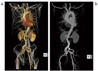}P@VR摜iajMIP摜ibj }N@\Ƒ쐫̌ŁCVR摜MIP摜̍쐬10xŊB