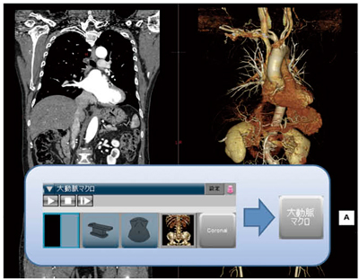 }2@哮ώ@}N̉ uCAEg؂ւvuQ䏜vuvuvZbgKpvuRi摜̕\v܂ŁCȀNbNŐiłB~}ł̑ffɂ͂ŏ\łB