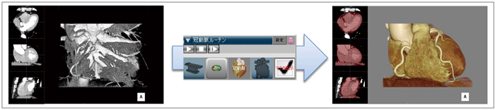 }2@摜F}N̉ uQ䏜vuwiFݒvuvZbgKpvuSovu}XN\v܂ŁCȀNbNŐiłB