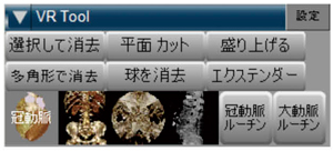 }3@pbg̃JX^}CY 摜ł́CقƂǂ̃pbg c[3D[`̉摜łB