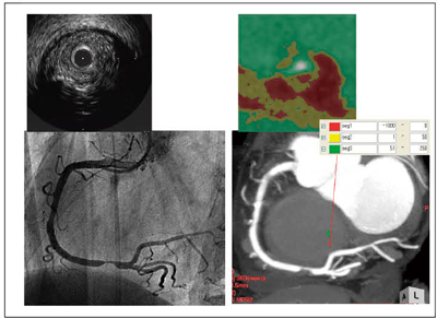 }3@eIVUSCǒSlab MIPƌǒZSlab MIPiŔȂ̂ŎۂɂMPRj̃J[}bv ǒZ̃J[}bvŉɈ͂܂ꂽԂlipid corẻ\̂铮daςF߂B