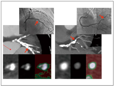 }4@ΊDaςSlab MIPŕ] ΊD]ɂ͕KCǒZŔSlab MIPiMPRjpB