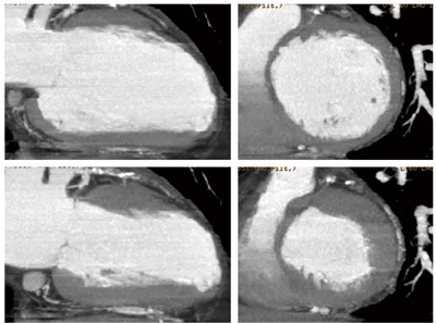 }5@ǐEǉ^Slab MIPŗeՂɕ]\