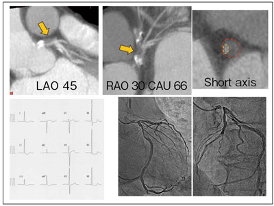 }6@ً}Ǘɑ΂Slab MIPpSCT]@̗Lp Sd}EtESGR[ŋ}ǌQ^킹鏊F߂ȂCSCT劲aςwEłǗB
