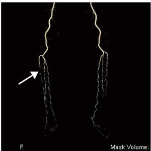 }2@ǐVR摜 }N@\݂̂ō쐬ꂽVR摜ŁCEڂ̓O}̋߈ʑɖ2cmɂ킽ǂF߂邱Ƃłi쐬50bjB