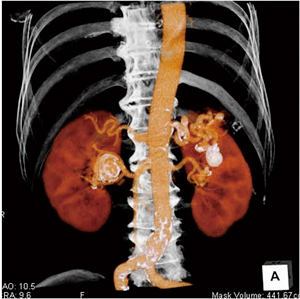 }3@tᎂVR摜 }N@\ō쐬̉摜iǁCѐtjdˍ킹ĕ\摜BEt啔ɒa2.6cm̕ǂ̐ΊDᎁBEtw}Nnwide neck̓ᎁCEt}Ɍa8mmCtɂa6mm̓ᎂF߂i쐬10jB