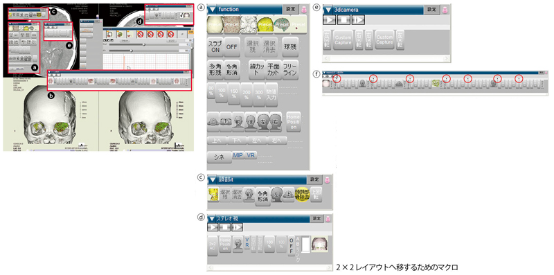 }1@XeIŎps߂2×2CAEg