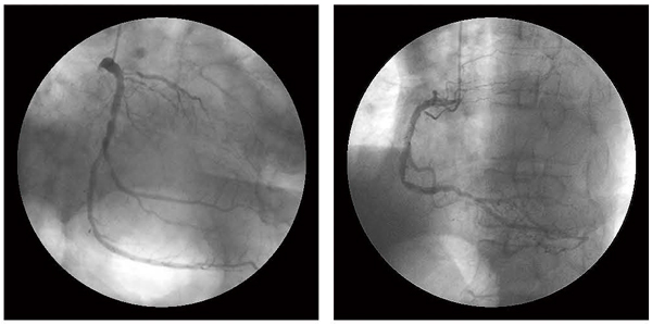 }7@CAG LAD#6ɊSǁCLCX#14ɍxC RCA#3ɒxaςF߂B 