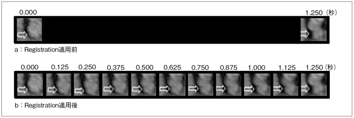 }1@ǉ^ւRegistration Techniquep̎ aFRegistration TechniquepOBω˂łBɁC→̕ω͑傫CA͒ǂȂB bFRegistration TechniquepB→CXɕωĂl悭킩B