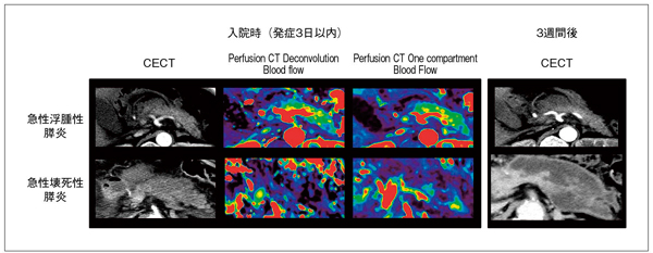 }3@ASYɂ摜̈Ⴂ@Deconvolutionibox-MTFjƁCOne CompartmentiZiosoft, Inc., Tokyo, JapanjɂāCꂼꓯǗX\́BǑX̗LC̓ASYɂĕ\Ă邪COne Compartment@̕C킩₷摜łCǗᐔ𑝂₵Ă̐x؂\łB
