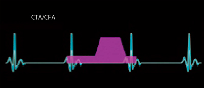 }2@CTvgR[ 320CTiŃfBJVXeYАAquilion ONEjp2mmԊuC1S10%Ԋu10tF[Ỷ摜č\zCUCI\tgА[NXe[VuZIOSTATIONvCTS@\̓\tgpāCAutoManualɂč@\wWZoB