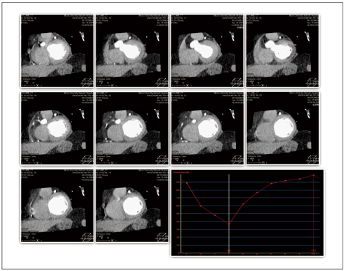 }4@320CTɂS@\́iAutoj