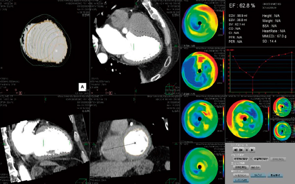 }5@320CTɂS@\́iAutoj