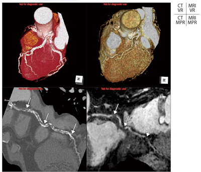 }4@ Ǘ2FxΊD̊CTAƊMRA CTł͍xΊD̂߂ɏڍו]ł邪CMRAƑgݍ킹邱ƂŐӔCaς𓯒肷邱Ƃ\ƂȂB̂悤ȃAv[`ł΁CΊDaςɔYޓ͊҂̊XN[jOƐg߂Ȃ̂ƂȂ邱Ƃ҂B 