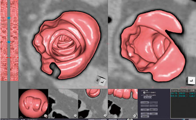 }4@ 2̈ʔr\F VE{MPR\CAEg 