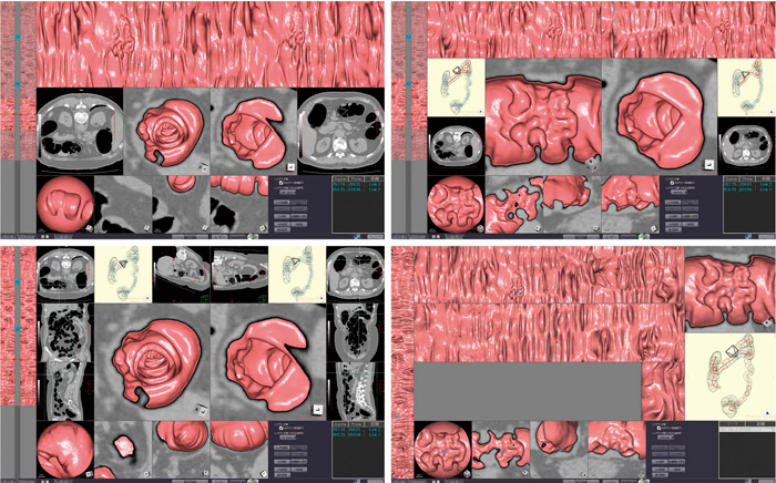}5@ }2`4̃CAEgȊOɂCʂړIʂɕ̃CAEgp 