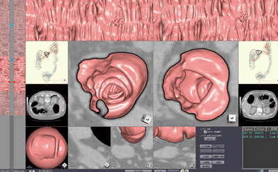 }1@CT咰̓\tg 2̈ʔrCAEg\ 