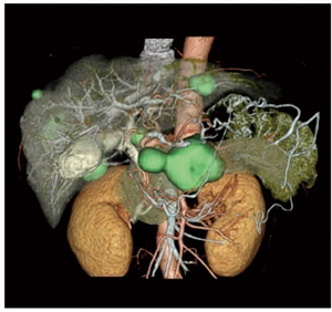 }5@ CTCMRICPETdˍ킹摜 