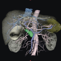 }2@ }`f[^t[WFCT{PET{MRI摜