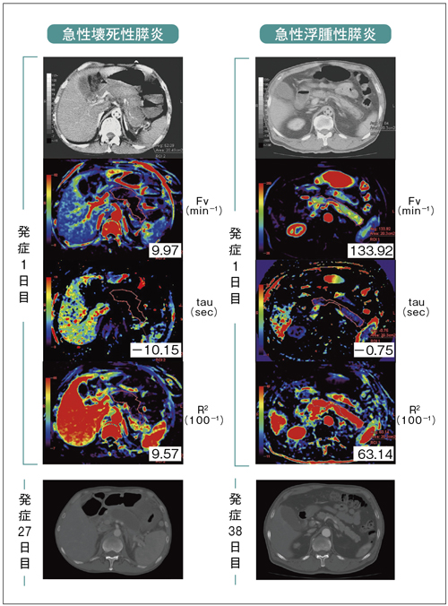 }5@}󎀐XƋ}Xɂ鏈̈
