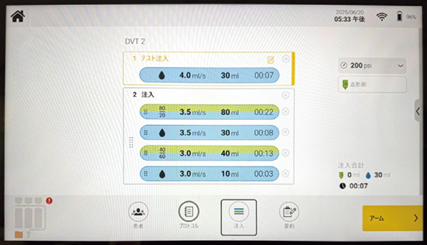 図1　Centargoを用いた同時注入プロトコル（新しい操作室モニター） 同時注入を用いた場合セットした造影剤と注入時mLあたりのヨード量が必ずしも一致しない
