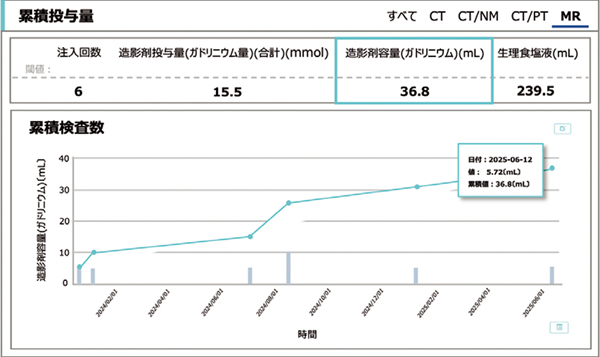 図3　Gd造影剤の累積投与量を示すグラフ