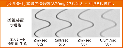 図5 均一に造影されたチューブ内の様子（同時注入時）（自験例）