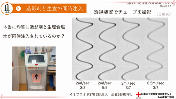 図6  同時注入時のチューブ内の様子(自験例)