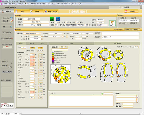 図1　心エコーレポート画面