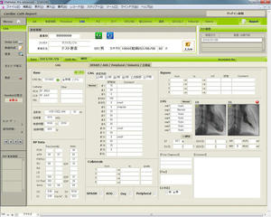 図3　心カテレポート画面