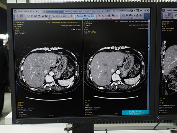「TrueFidelity」（右）は大幅にノイズ低減を実現