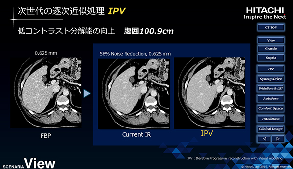 逐次近似処理技術「IPV」による画像