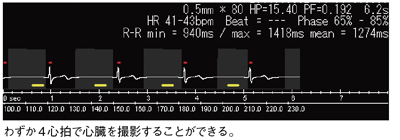 症例1 心電同期フラッシュスキャンシステム