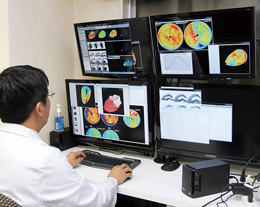 EBWやComprehensive imaging viewerを駆使して，包括的な心臓レポートを作成する。