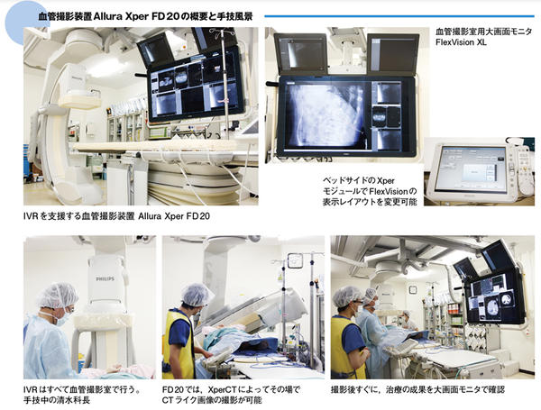 血管撮影装置Allura Xper FD20の概要と手技風景