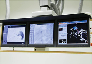 TACE手技中に室内のモニタにEmboGuideの画像（右）を表示する。