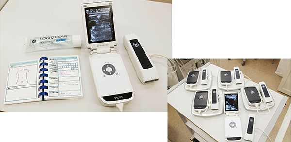 14台導入されたVscanは外来や病棟で触診補助マシンとして活用
