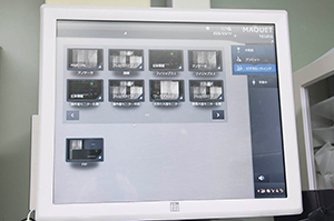 マッケの手術室画像映像統合システム「TEGRIS」