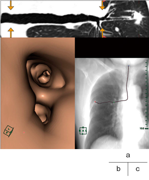 図5　仮想内視鏡表示機能