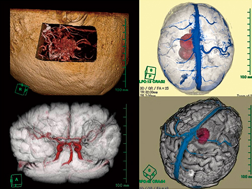 図3　手術シミュレーションイメージ